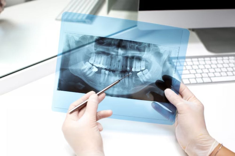the-technology-behind-dental-x-rays-how-its-changing-modern-dentistry