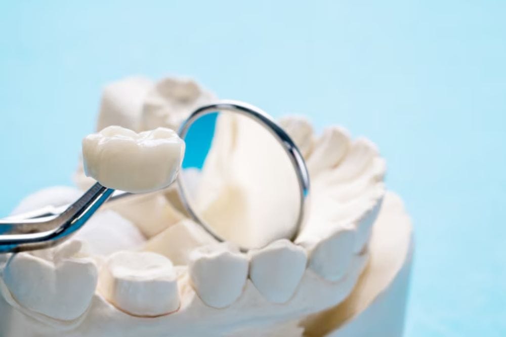 choosing-the-right-dental-crown-materials-options-and-benefits