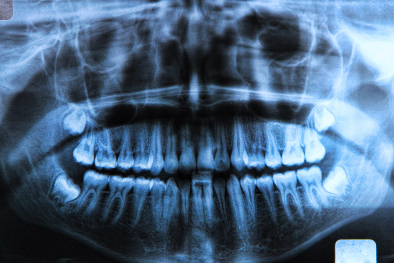 Dental x-ray near you